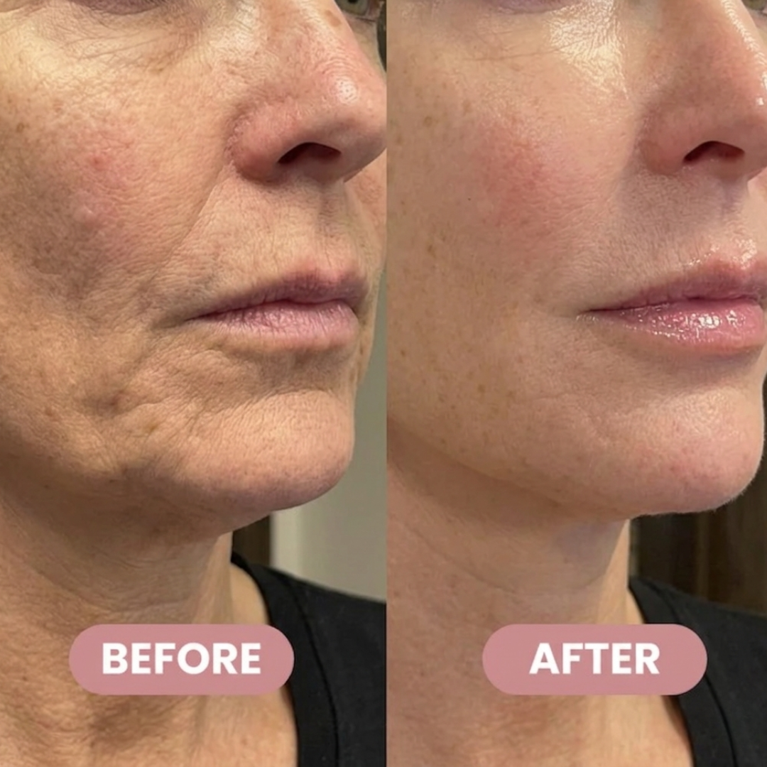 Wrinkle Bounce Multi Balm Stick