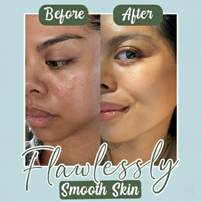 Green Tea Deep Cleanse Mask – Pore Detox & Glow